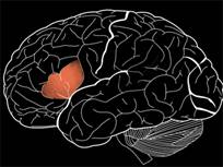 Физиологи уточнили местоположение нейронов речи